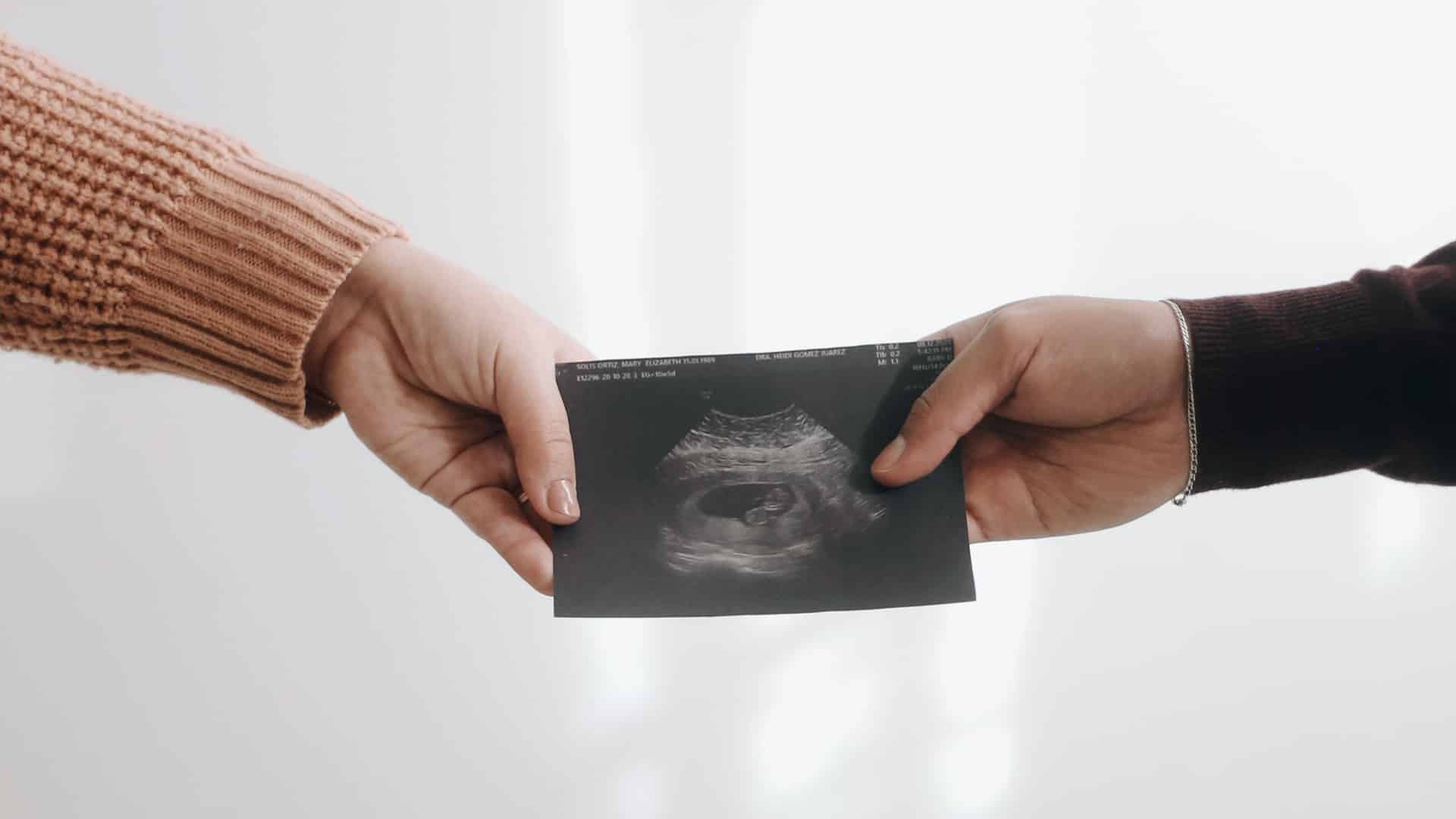 Explainer: What you should know about the Texas Heartbeat Act and the Supreme Court